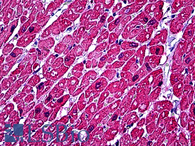 IHC-plus™ TNNC1 / Cardiac Troponin C Antibody
