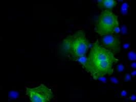 PSMC3 Antibody (clone OTI9G5)