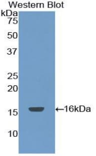 F7 / Factor VII Antibody (aa42-169)