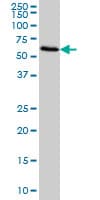 FGL2 Antibody (clone 6D9)