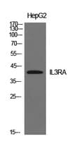 Polyclonal Rabbit anti-Human IL3RA / CD123 Antibody (WB)