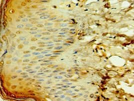TCTN2 Antibody (aa420-670)
