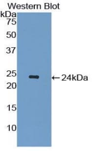 IL1RN Antibody (aa26-176, Biotin)