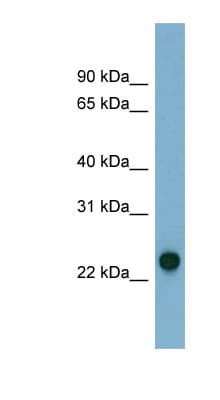 AK3 / Adenylate Kinase 3 Antibody (N-Terminus)