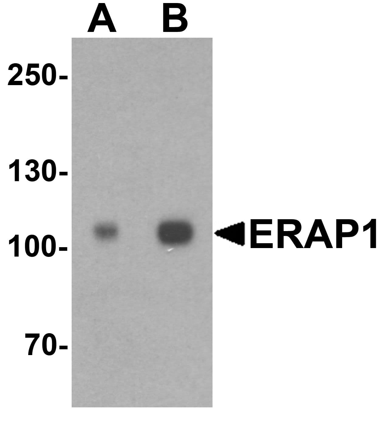 ARTS1 / ERAP1 Antibody