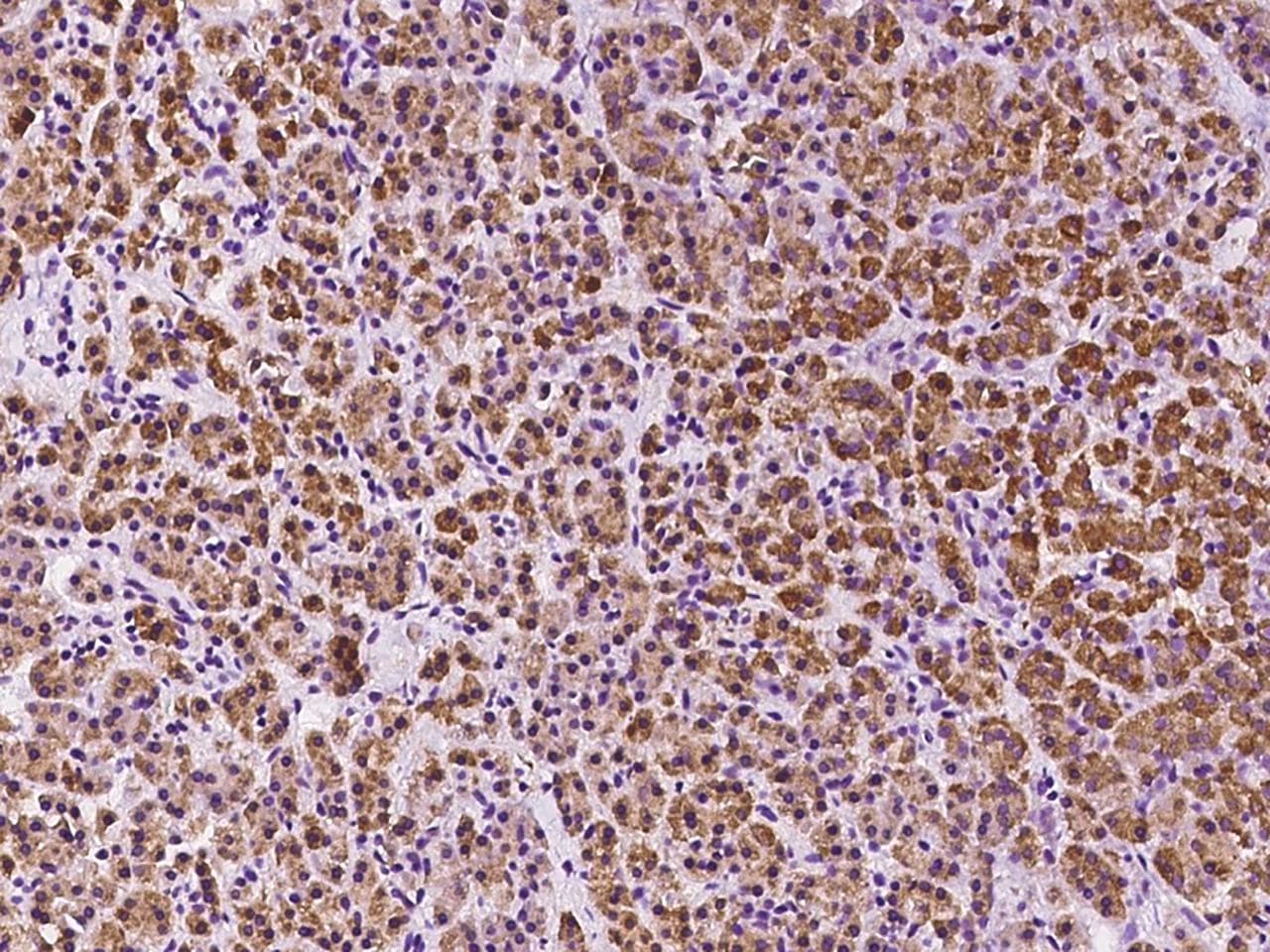 DHRSX Antibody