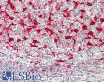 IHC-plus™ CRIP1 Antibody (aa48-77)