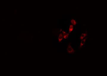 ARHGAP12 Antibody