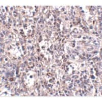 SCARB1 / SR-BI Antibody