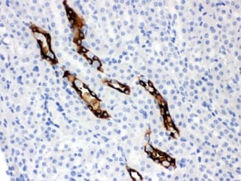 Polyclonal Rabbit anti-Human AQP2 / Aquaporin 2 Antibody (IHC, WB)