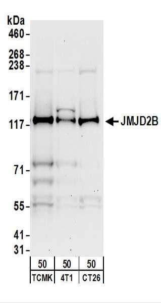 IHC-plus™ Polyclonal Rabbit anti-Human KDM4B / JMJD2B Antibody (aa1056-1096, IHC, WB)