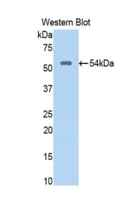NUP188 Antibody (aa540-782)