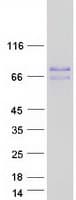 Human MID1 Protein (Recombinant Myc-DDK (Flag))