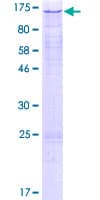 Human RAD21 Protein (Recombinant GST)