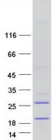 Human MGC70863 Protein (Recombinant Myc-DDK (Flag))