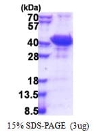 Human CCM2 / Malcavernin Protein (Recombinant His)