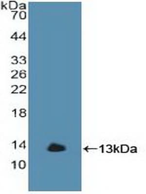 GBA / Glucosidase Beta Acid Antibody (aa117-214, Biotin)