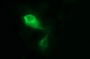 MMP13 Antibody (aa104-471, clone OTI1G5)