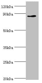 IHC-plus™ CDH11 / Cadherin 11 Antibody (aa637-796)