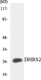 DHRS2 / HEP27 Antibody (aa97-146)