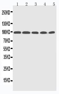 PR / Progesterone Receptor Antibody (aa595-933)