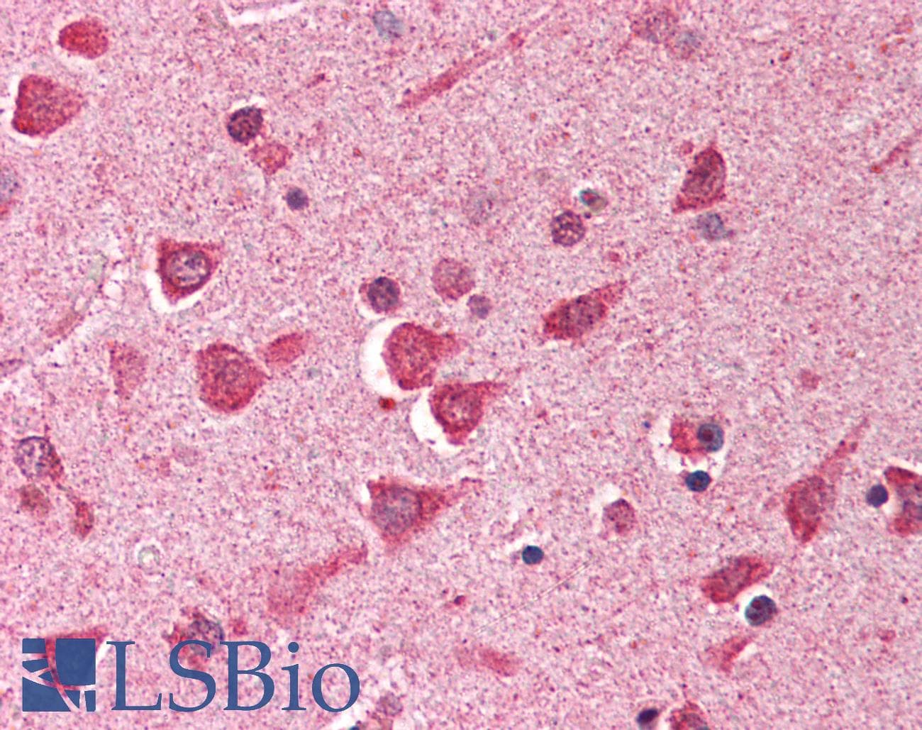 IHC-plus™ ING1 Antibody (aa275-300)