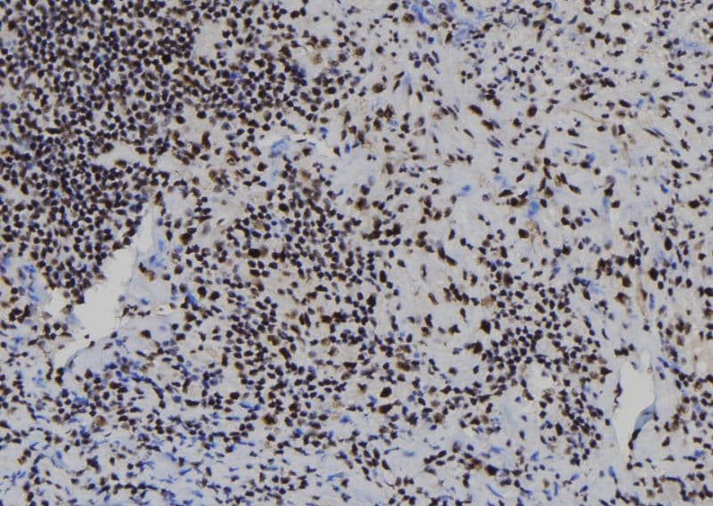 RBBP7 / RbAp46 Antibody