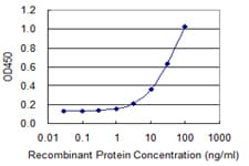 NAPSA / NAPA / Napsin A Antibody (clone 4G6)