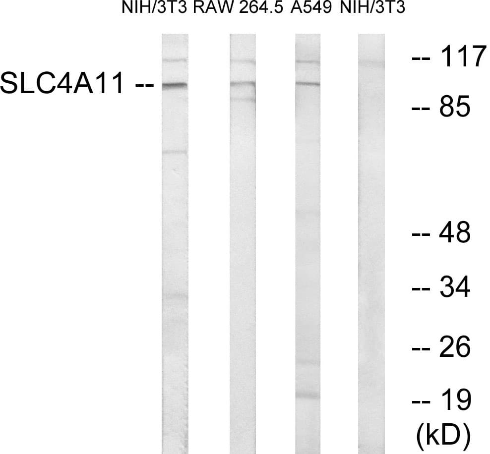 Polyclonal Rabbit anti-Human SLC4A11 / NABC1 Antibody (aa291-340, WB)