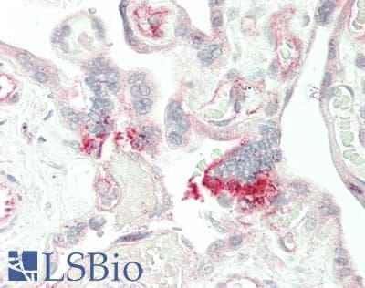 IHC-plus™ transmembrane channel-like 1 Antibody