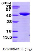 Human GLRX3 / Glutaredoxin 3 Protein (Recombinant His)