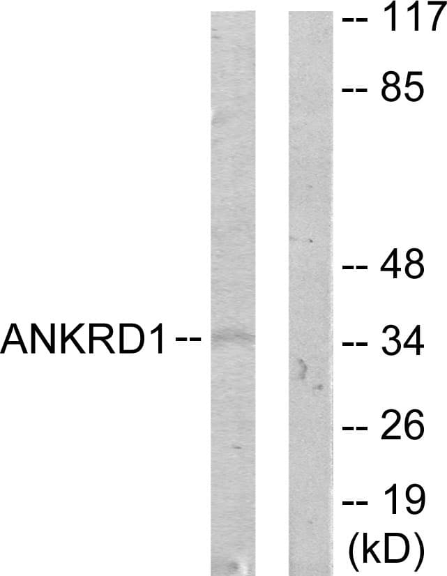 CARP / ANKRD1 Antibody (aa231-280)
