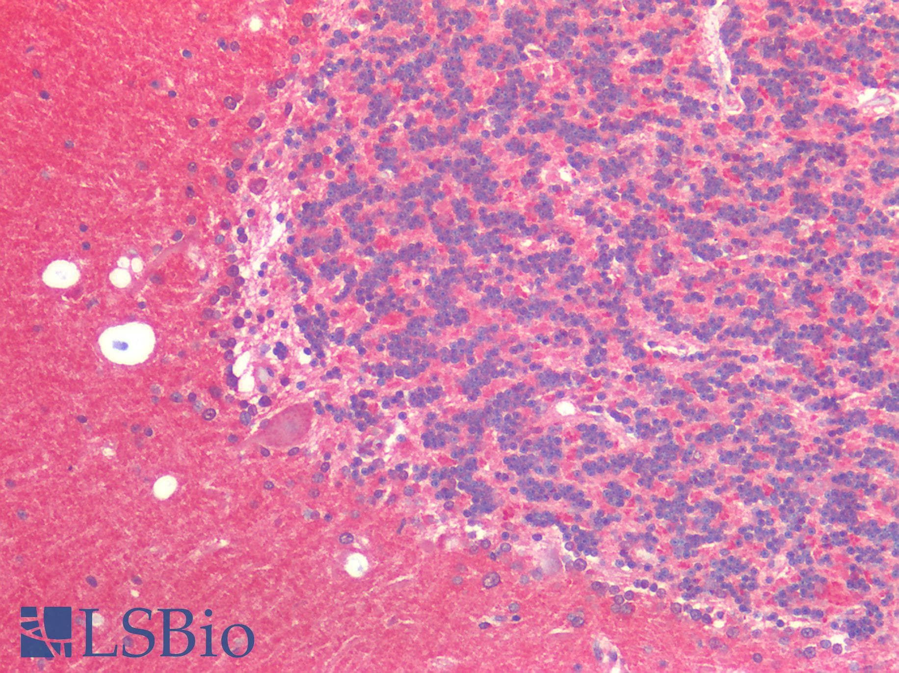 PathPlus™ Monoclonal Mouse HTT / Huntingtin Antibody (clone HDC8A4, aa2703-2911, IHC, WB)