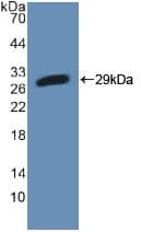 PFKP Antibody (aa247-473, Cy3)