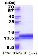 Human MTCP1 Protein (Recombinant His)