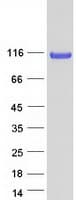 Human SRRT / ARS2 Protein (Recombinant Myc-DDK (Flag))