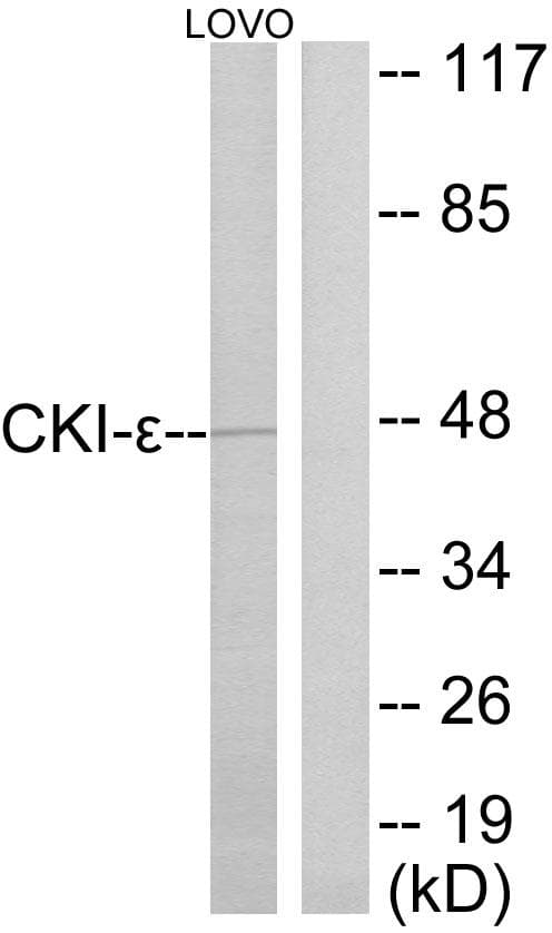 CSNK1E / CK1 Epsilon Antibody