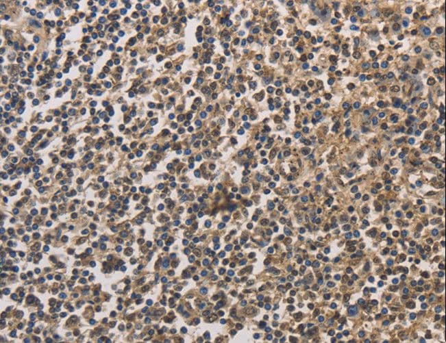 DRG1 / NEDD3 Antibody