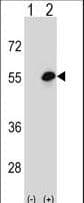 Cochlin / COCH Antibody (aa399-428)