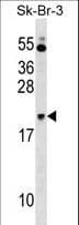 NKIRAS1 Antibody (aa48-76)