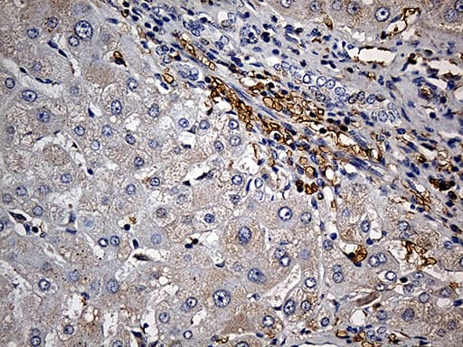 JUP/CTNNG/Junction Plakoglobin Antibody (aa500-745, clone OTI4D5)