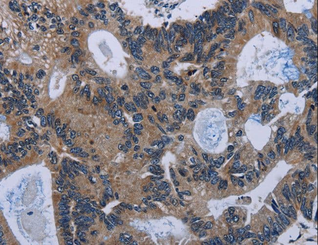 IRGM / LRG-47 Antibody