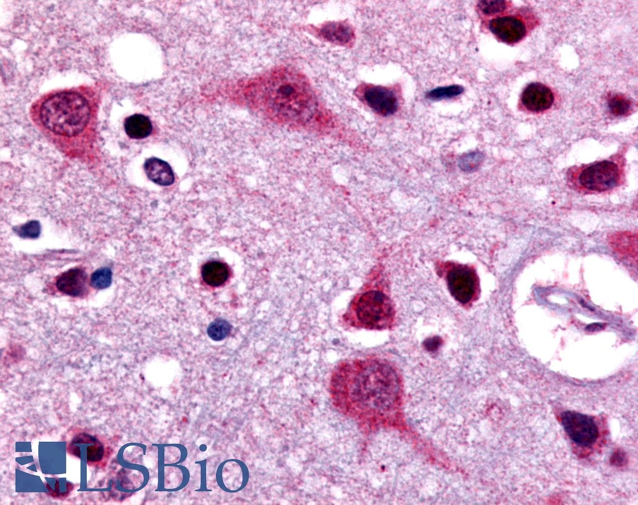 IHC-plus™ GPR48 / LGR4 Antibody (N-Terminus)