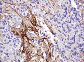 NRAS / N-ras Antibody (clone OTI5G7)