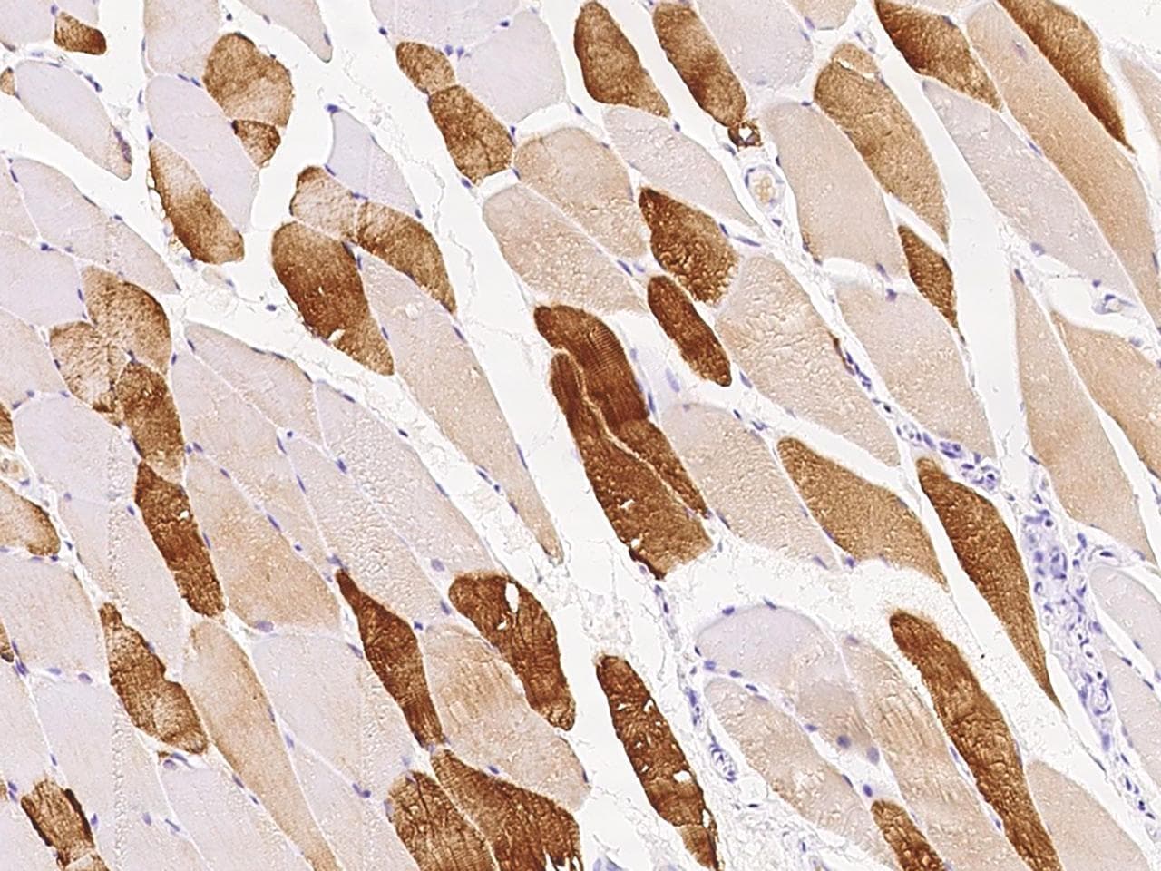 Polyclonal Rabbit anti-Human IGIP / C5orf53 Antibody (IHC)