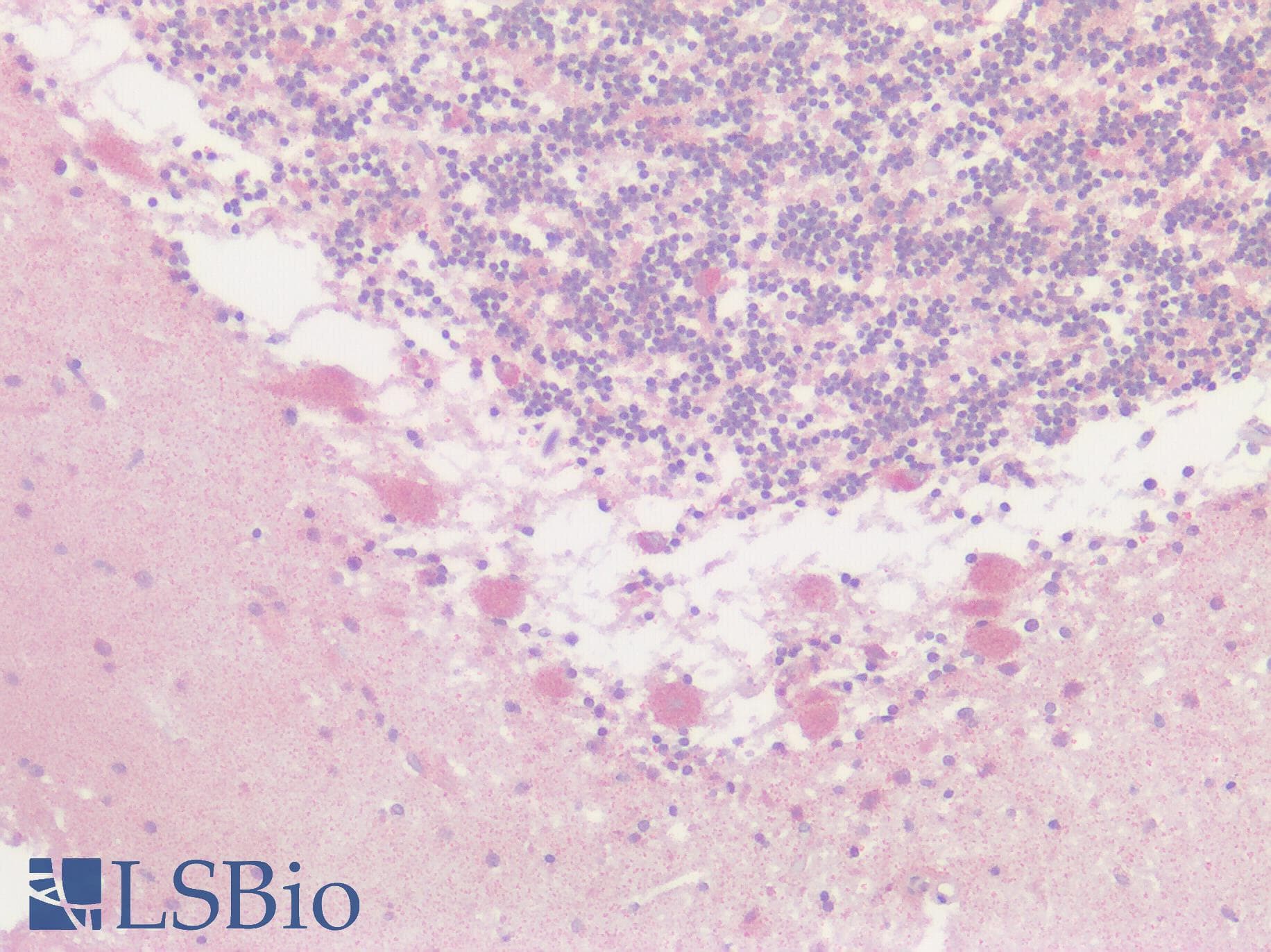 IHC-plus™ GPRC5D Antibody (Cytoplasmic Domain)