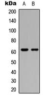 CERKL Antibody (Internal)