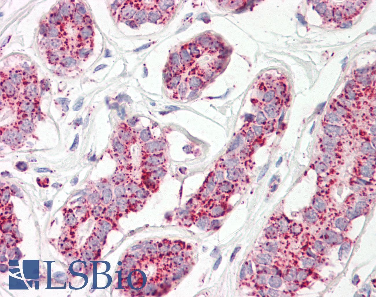 IHC-plus™ Polyclonal Goat anti-Human ACO2 / Aconitase 2 Antibody (aa541-555, IHC, WB)