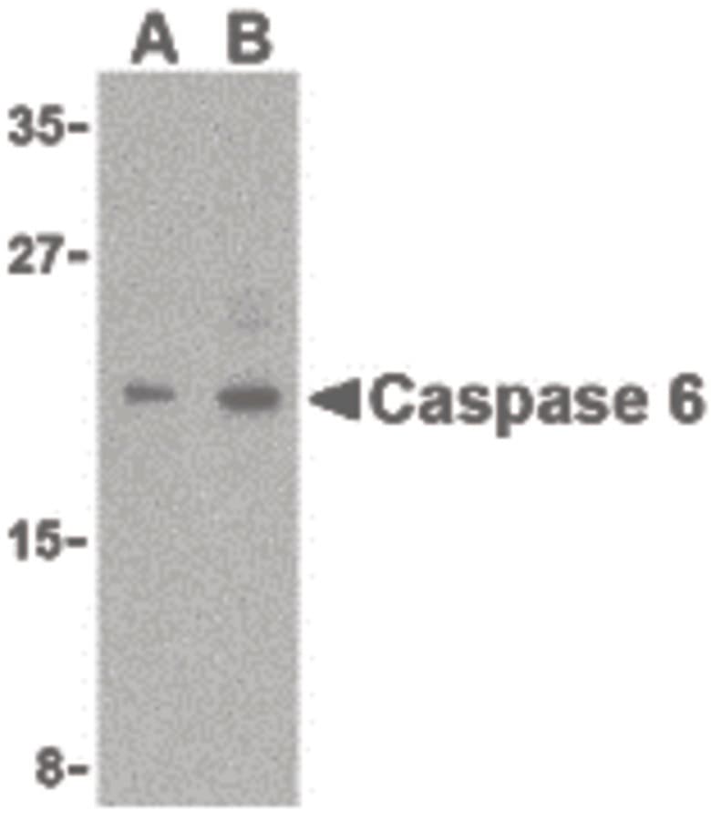IHC-plus™ CASP6 / Caspase 6 Antibody