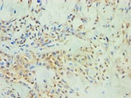 Polyclonal Rabbit anti-Human SPIN2B Antibody (aa1-258, IHC, WB)